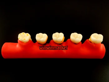 5 Fáze Zubár Odontologia Periodontal Choroby Zubné Zuby Model Zuba ZYR-4010